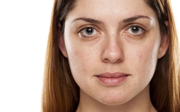 Skin tightening and rejuvenation with Procell microchanneling face and neck Georgia, face and neck skin renewal treatment collagen boosting Villa Rica GA, Procell microchanneling treatment improving fine lines wrinkles and skin texture before after, Scar, stretch mark and surgical scarring rejuvenation treatment Procell microchanneling improving texture and appearance Georgia, Natural skin healing and regeneration microchanneling treatment